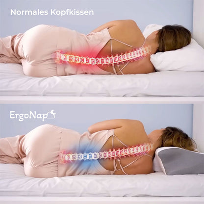 ErgoNap™ Nackenstützkissen